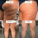 CryoGold Gel Reafirmante Corporal Criotermico