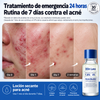 Loción Secante Para Acne