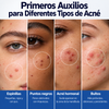 Loción Secante Para Acne